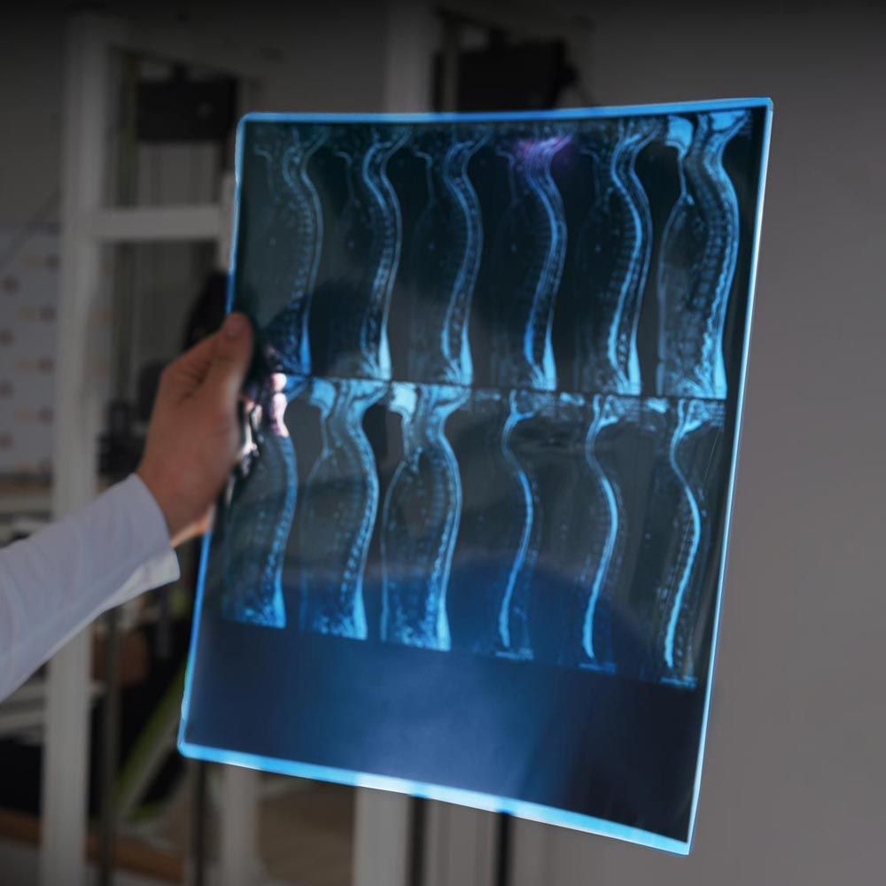 Man looking at x-rays of spine